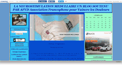 Desktop Screenshot of douleurviolentes.canalblog.com