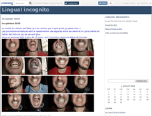 Tablet Screenshot of lingualincognito.canalblog.com