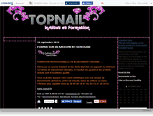 Tablet Screenshot of blanchimentdent.canalblog.com