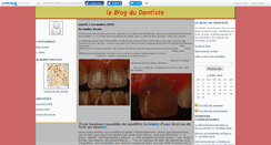 Desktop Screenshot of ggrandodentiste.canalblog.com